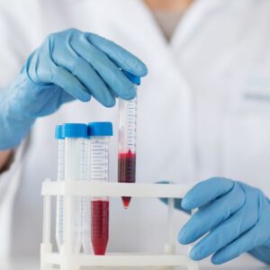Lab Word/Blood Exam